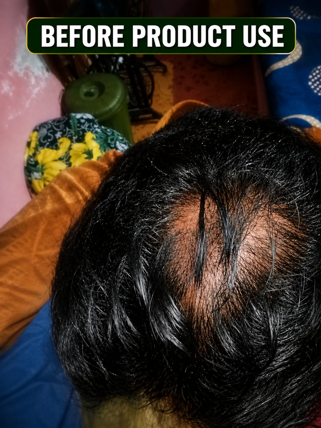 Real Customer Result – After 5 Weeks
